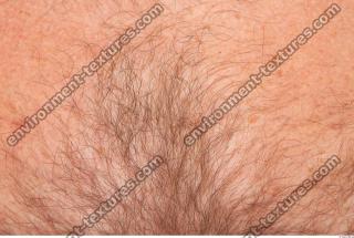 human skin hairy 0003